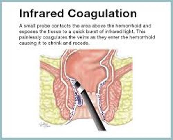 Kashid Hospital Piles Treatment Ahmednagnar